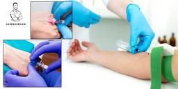 رگ گیری | نکات مهم در رگ گیری | جمشیدیان هِلث