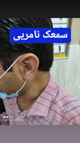 ناشنواها شنوا شدن!