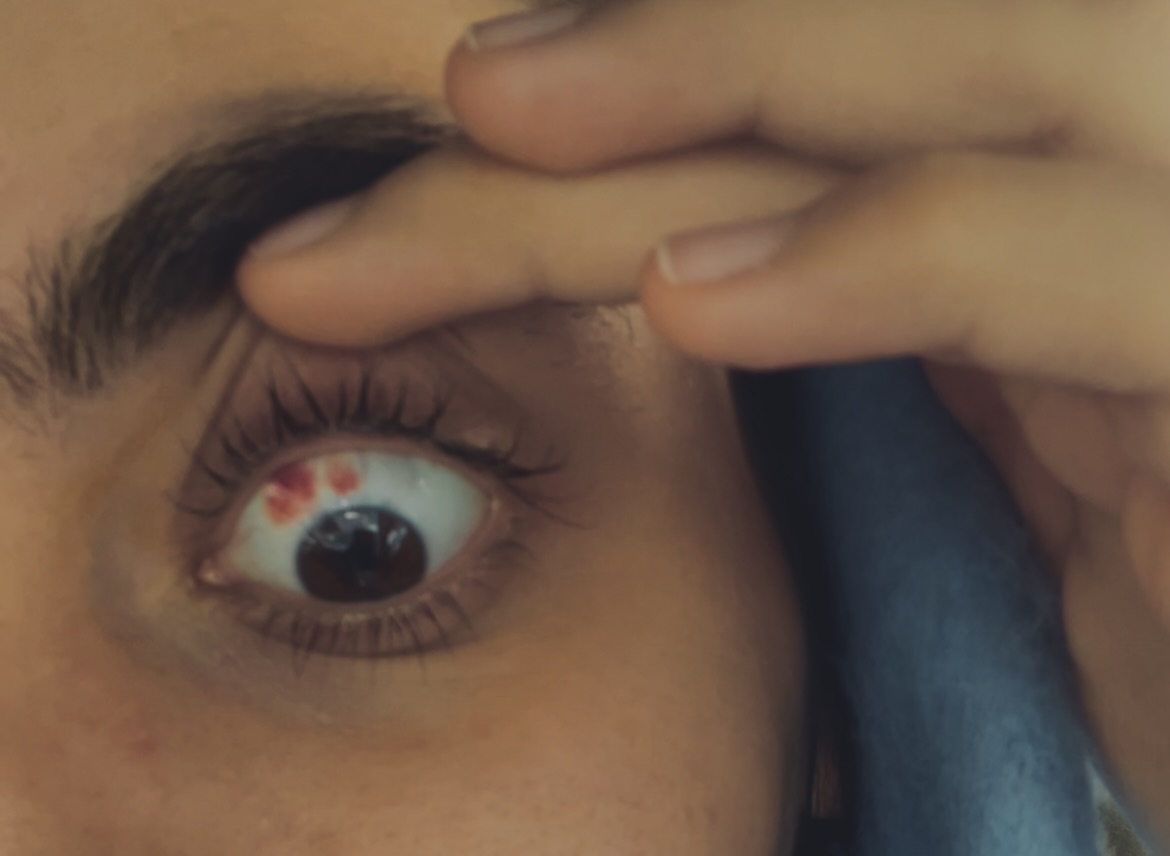 آثار بعد از جراحی ..