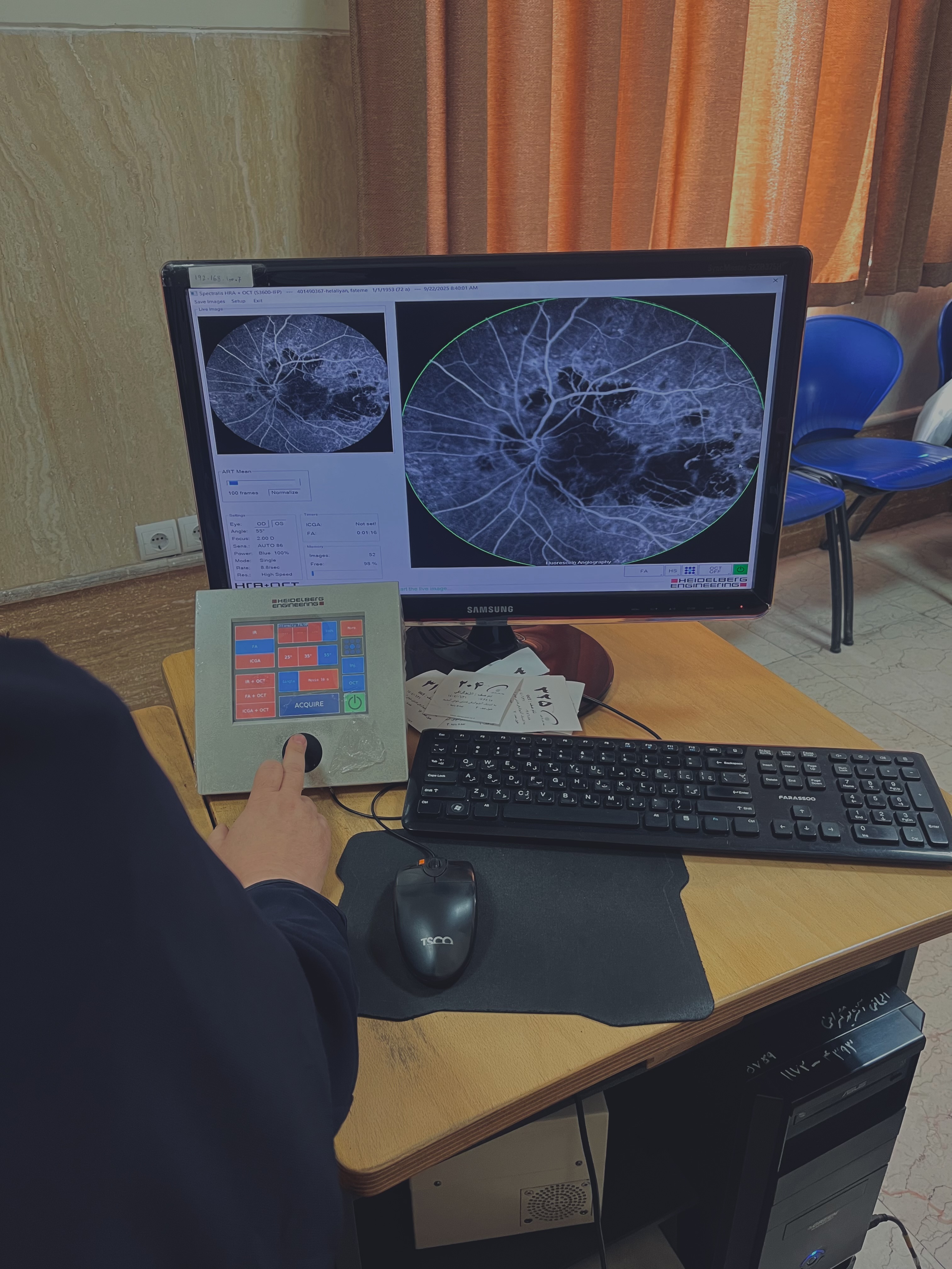 بیمارستان فارابی-بخش انژیو گرافی چشم-پدیده ی رعد و برق که همزمان با تزریق ماده به بدن بیمار وارد عروق چشم میشه و اونهارو قابل مشاهده میکنه..