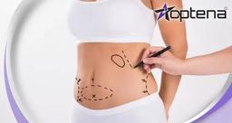 هزینه لیپوماتیک در کرج