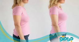 لیفت سینه چیست؟