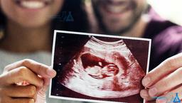 غربالگری به چه معناست؟اهمیت غربالگری پیش از بارداری