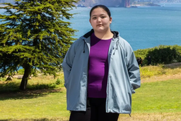 تاثیر دستگاه لیزر لونا بر لاغری