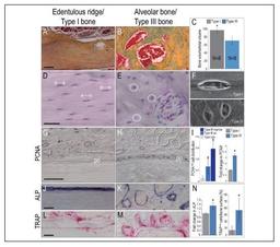 رابطه بین کیفیت استخوان و یکپارچگی استخوانی ایمپلنت (مقاله ترجمه شده)