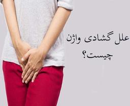 درمان گشادی واژن با واژینوپلاستی