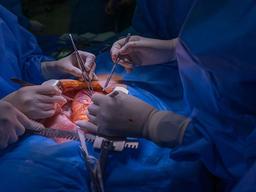 پیوند لوزالمعده/پانکراس