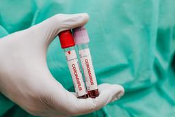 چه کاری بکنیم که قرنطینه بهمون بد نگذره؟