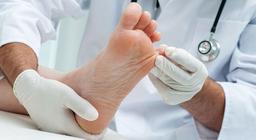 نکاتی درباره زخم دیابتی انگشت پا