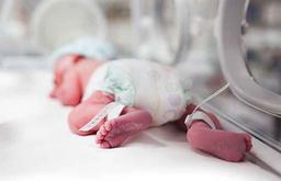 پره اکلامپسی و نوزاد نارس