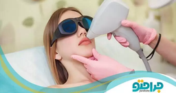 مزایای انجام لیزر موهای زائد