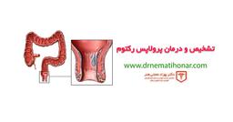درمان بیرون زدگی مقعد یا پرولاپس رکتوم