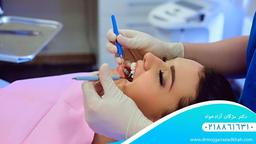 ایمپلنت بهتر است یا روکش دندان؟