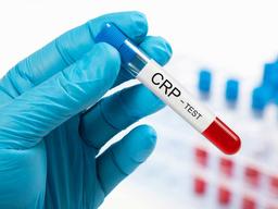 رابطه CRP و بیماری های قلبی عروقی