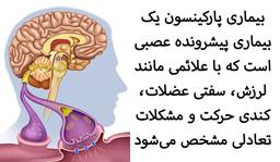 پارکینسونیسم چیست و چه تفاوتی با پارکینسون دارد؟
