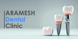 قیمت و هزینه ایمپلنت کره ای 1402