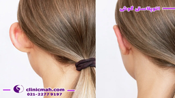 کربوکسی تراپی چیست و چگونه انجام می شود؟