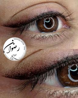 شیدینگ چشم چیست؟