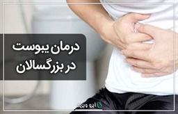 درمان یبوست در بزرگسالان