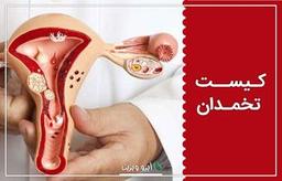 کیست تخمدان