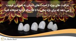 کامپوزیت بهتر است یا لمینت؟ 5 تفاوت بارز لمینت و کامپوزیت دندان