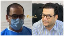 آیا بیمه هزینه کاشت مو را پرداخت می کند؟