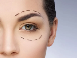 the best age for blepharoplasty