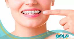 ارتودنسی و کاربرد آن