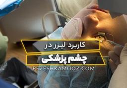 کاربرد لیزر در چشم پزشکی