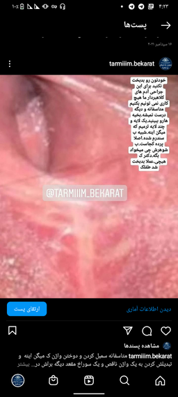 رایج ترین اشتباهات جراحی ترمیم بکارت(دکتر فرهمند فوق متخصص زنان و زایمان جراح ترمیم بکارت و زیبایی زنان)