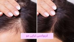 تقویت و رشد موها با کربوکسی تراپی