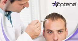 بهترین دکتر کاشت مو در شیراز کیست؟