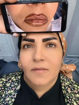 راهنمایی برای پاک کردن تتو خط لب با لیزر