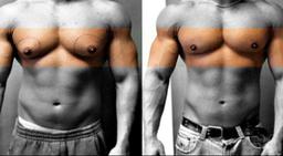 بزرگ شدن سینه مردان