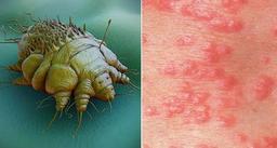 سمپاشی گال در منزل