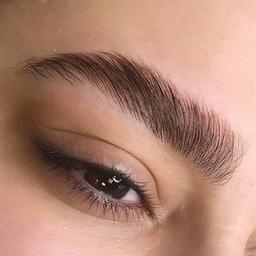 مزایا و معایب فیبروز ابرو