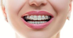مقابله با استرس در ارتودنسی