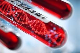 بهترین زمان انجام آزمایش سل فری