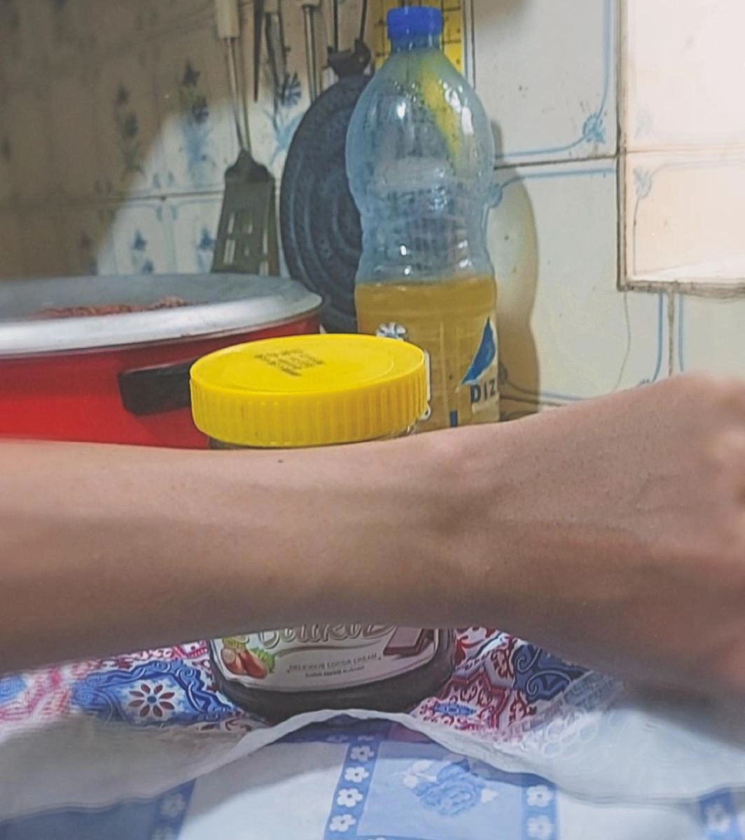 دور مچ دست من