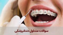 سؤالات متداول دندانپزشکی و پاسخ متخصصین