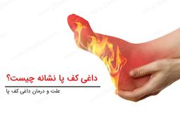 داغی کف پا نشانه چیست؟