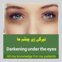 تیرگی زیر چشم