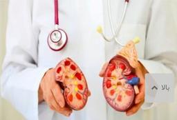 چه عواملی موجب تشکیل سنگ کلیه می‌شود؟