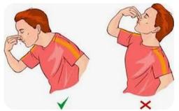 بند آوردن خون ریزی بینی