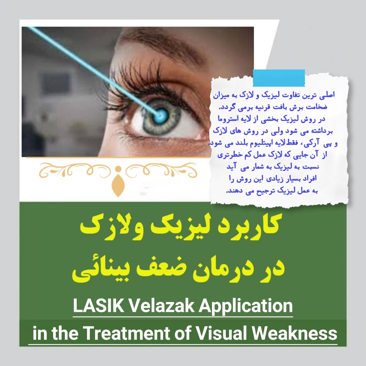 کاربرد لیزیک و لازک