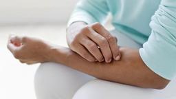 لباس ورزشی و آلرژی