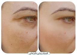 بهترین مراکز پی ار پی در رشت + تجربه شخصی من