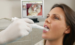 دوربین داخل دهانی دندانپزشکی