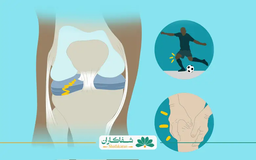حرکات مضر برای مینیسک زانو زانویتان محافظت کنید