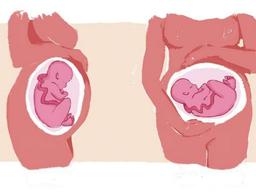 وضعیت عرضی چنین چگونه است؟